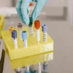 Jak wyglądają badania kliniczne krok po kroku i kto może w nich uczestniczyć